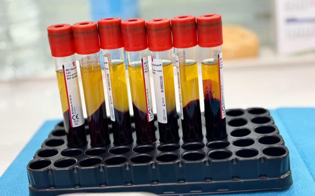 NUEVA TÉCNICA DENTAL – L-PRF